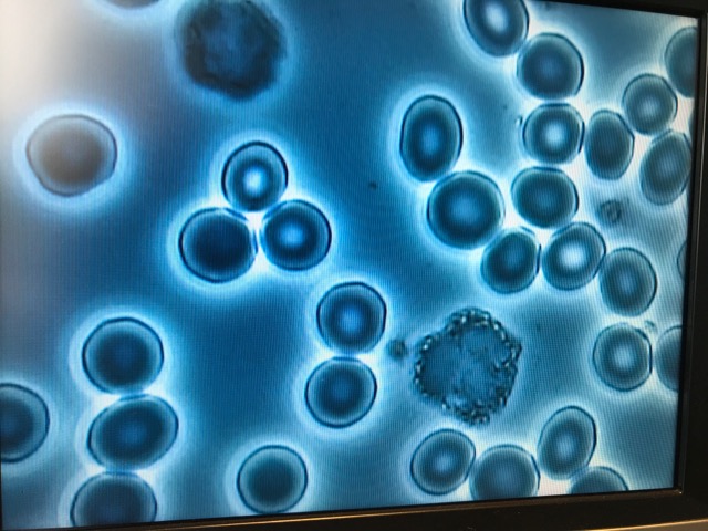 D3F3AD46-CA87-4EF4-9F7B-43AED64DB9BA